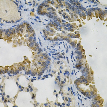 AKR1B1 Antibody