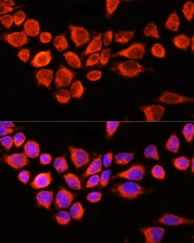 AADAC Antibody