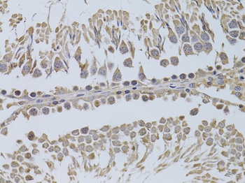 P2RY2 Antibody