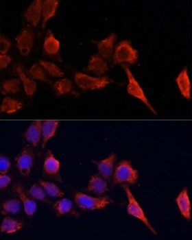 TIMP1 Antibody