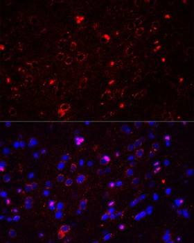GRIN2A Antibody