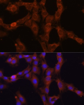 GANAB Antibody