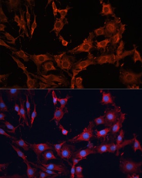 SLC25A27 Antibody