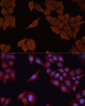 SLC25A27 Antibody