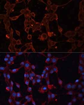 SLC25A27 Antibody