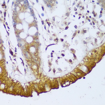 GCC2 Antibody