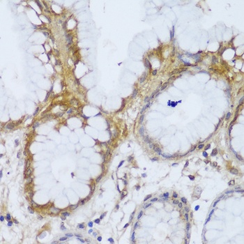 GCC2 Antibody