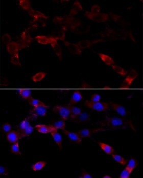 CYP1B1 Antibody