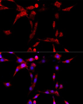 CYP1B1 Antibody