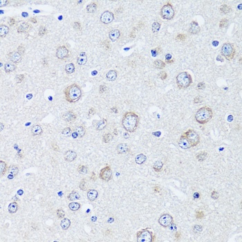 HSF1 Antibody