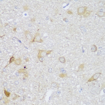 EDC3 Antibody