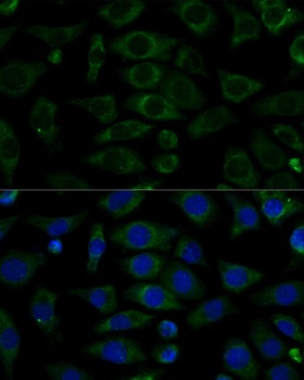 NDUFB7 Antibody