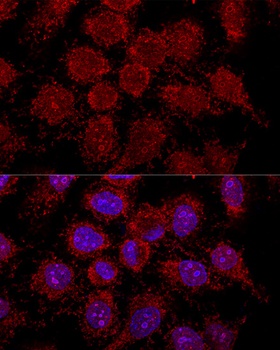 RPL30 Antibody