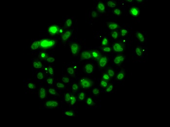 PMS2 Antibody