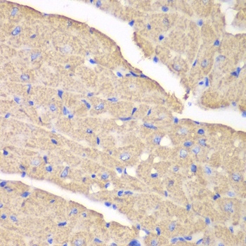 VDAC1 / Porin Antibody