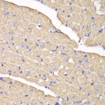 VDAC1 Antibody