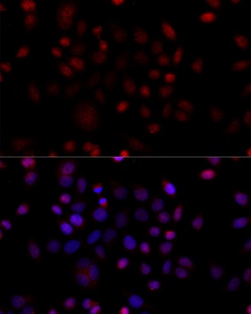 VDAC1 / Porin Antibody