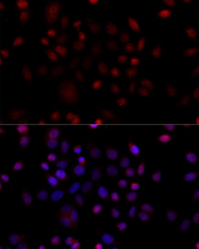 VDAC1 Antibody