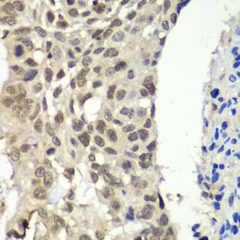 SSRP1 Antibody