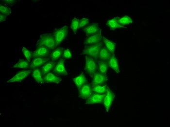 SSRP1 Antibody