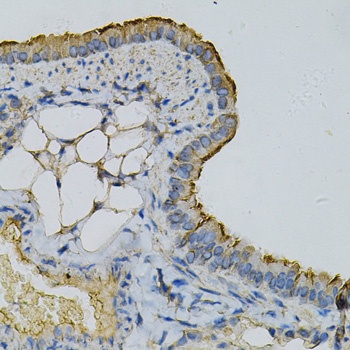 RPLP0 Antibody