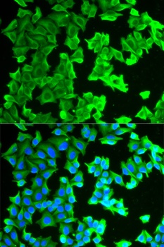 RPLP0 Antibody