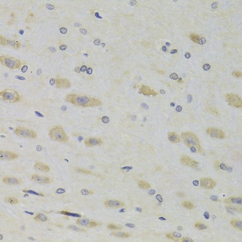 RPL9 Antibody