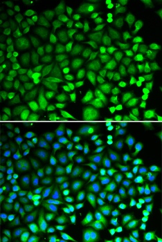 PSMB2 Antibody