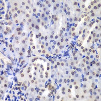 PRKCB Antibody