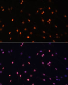 PRKCB Antibody