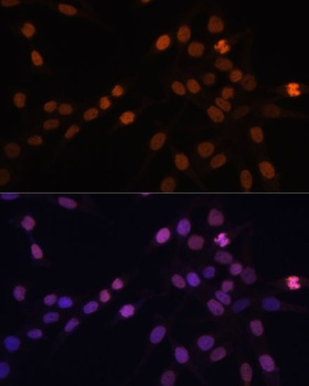 PRKCB Antibody