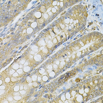 SERPINA6 Antibody