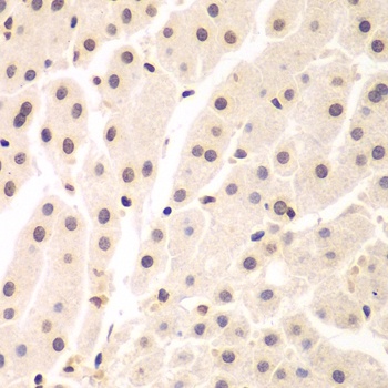 UHRF2 Antibody