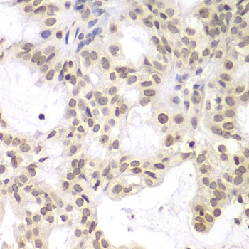 UHRF2 Antibody