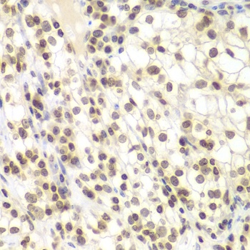 UHRF2 Antibody