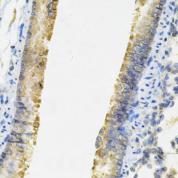 ACSS2 Antibody