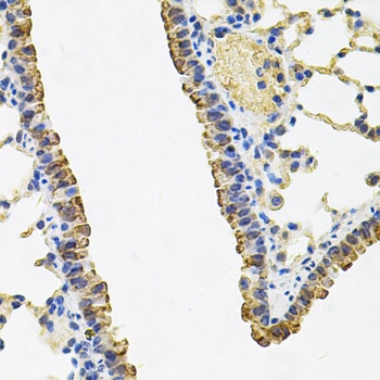 ACSS2 Antibody