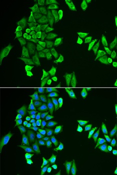 ACSS2 Antibody