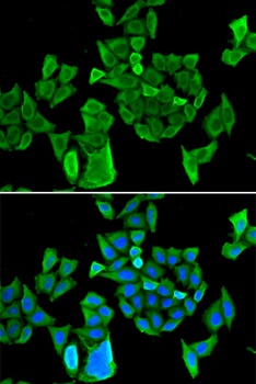 CCAR1 Antibody