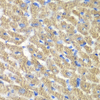 FIBP Antibody