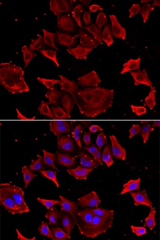 TCAP Antibody