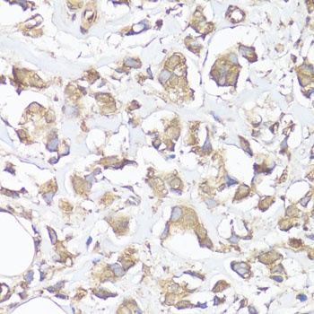 VTN Antibody