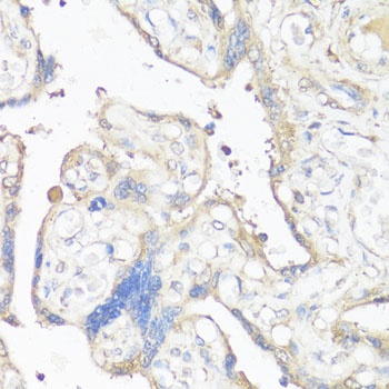 VTN Antibody