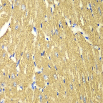 TPM3 Antibody