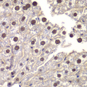 ST14 Antibody