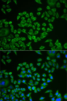 ST14 Antibody
