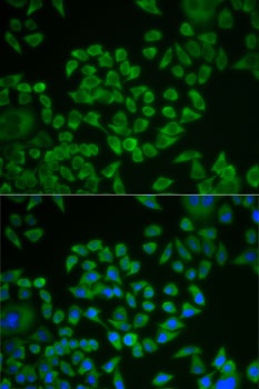 ST14 Antibody