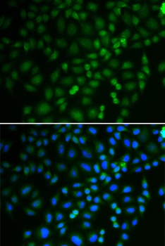 TRIM21 Antibody