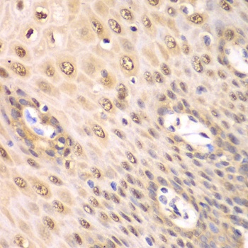 PSMA2 Antibody