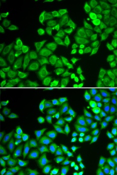 PPP4C Antibody